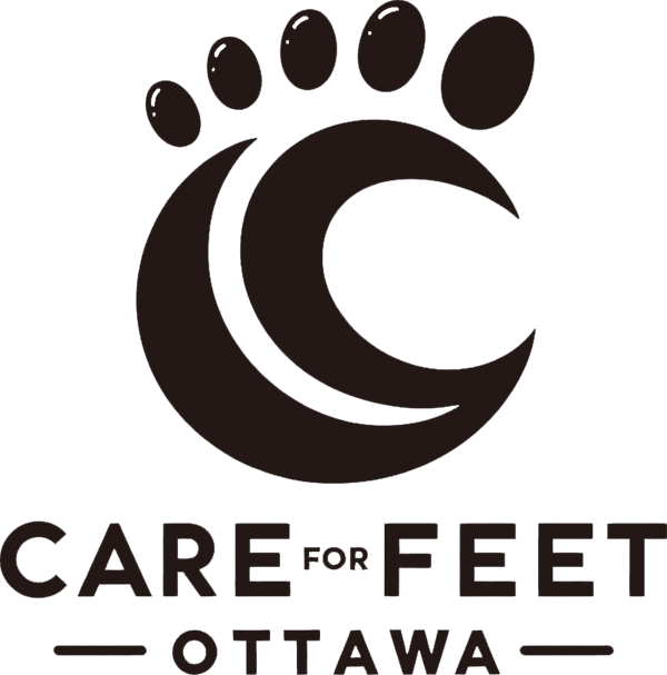 Care for Feet Ottawa